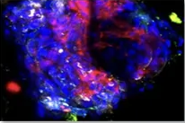 Fluorescence microscopy — Ad vector